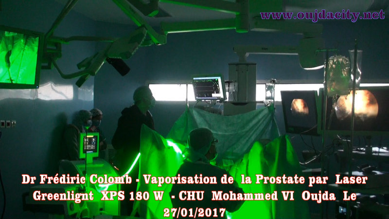 VIDEO أول عملية جراحية “بالليزر” للمسالك البولية بالمركز الاستشفائي الجامعي محمد السادس بجهة الشرق